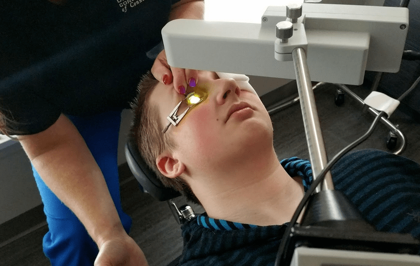 Crosslinging effectively eliminates keratoconus at the beginning of its development